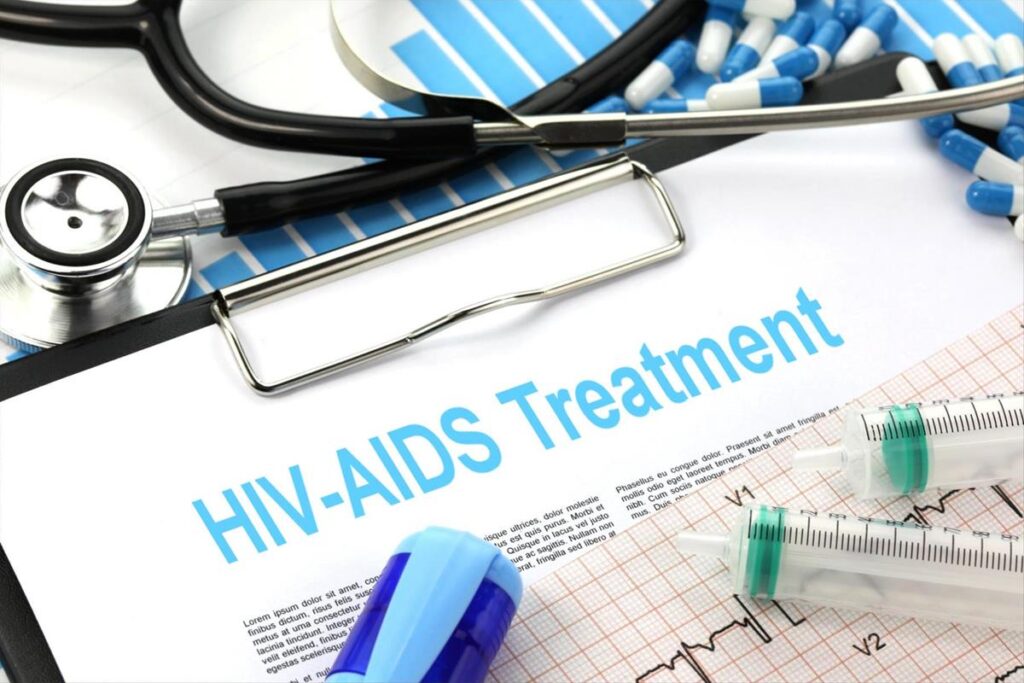 HIV and aids treatment